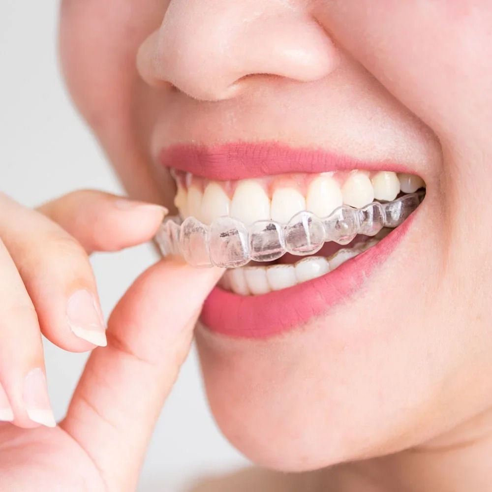 1-4 Adet Horlama Önleyici Bruk - Dental Guard Night incelemesi ve fiyatı
