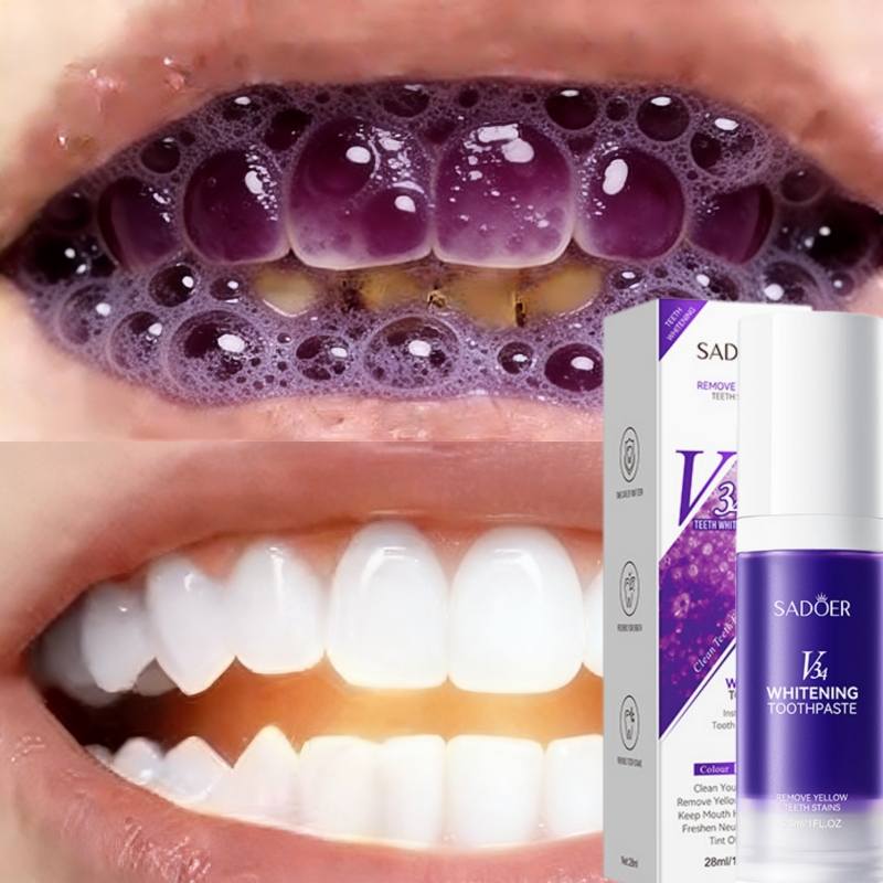 2026'nın En Çok Satan Beyazlat - Teeth Whitening Effective incelemesi ve fiyatı